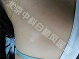 пưҽԺ